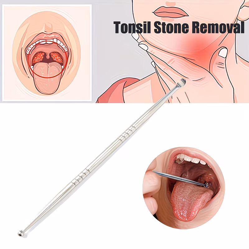Tonsil Stone Removal Tool